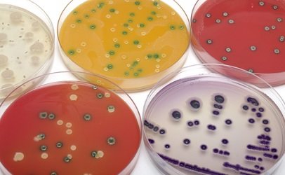 Salmonella Testing Salmonella Testing